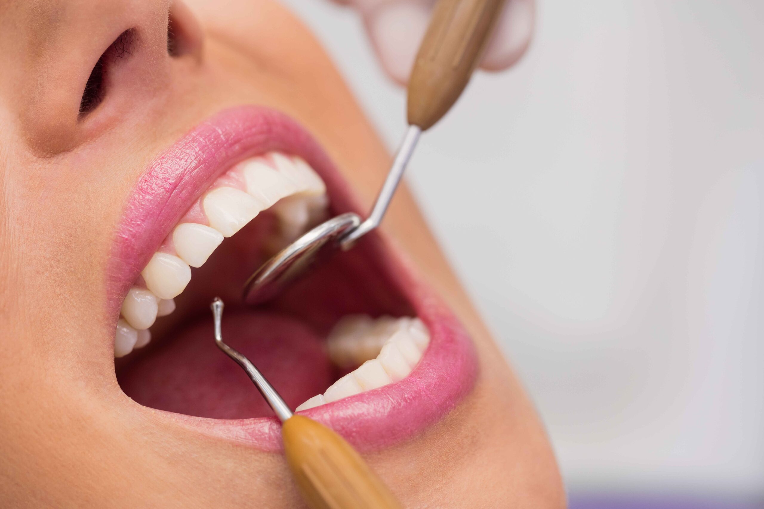 teeth aligners in Mira Bhayandar
