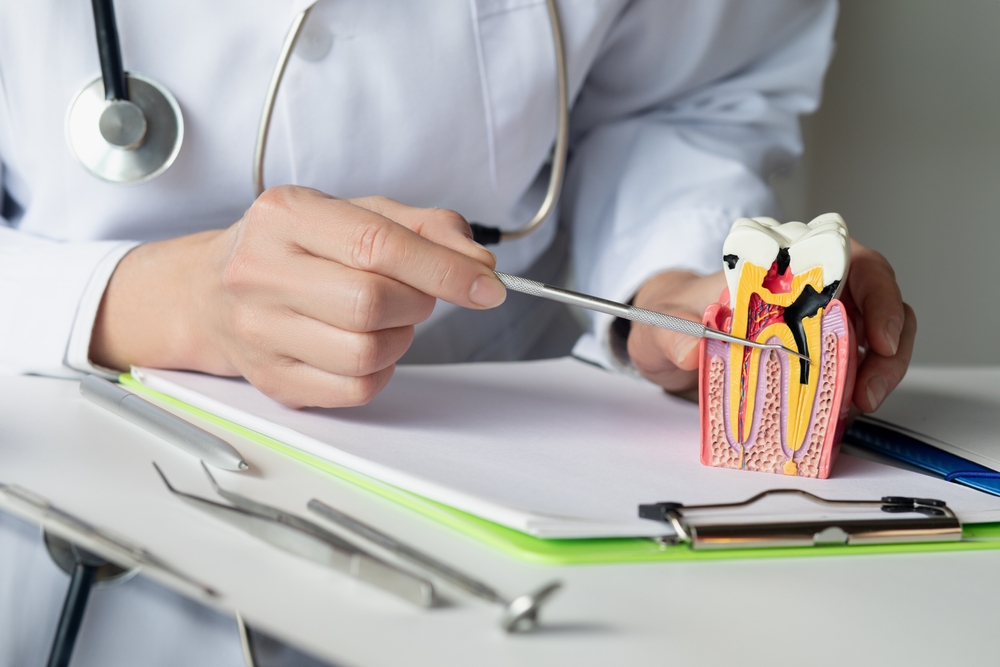 Root Canal Cost in Mira Road