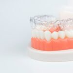 Invisible braces in mira bhayandar